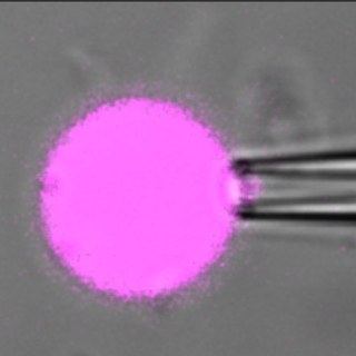 A giant vesicle