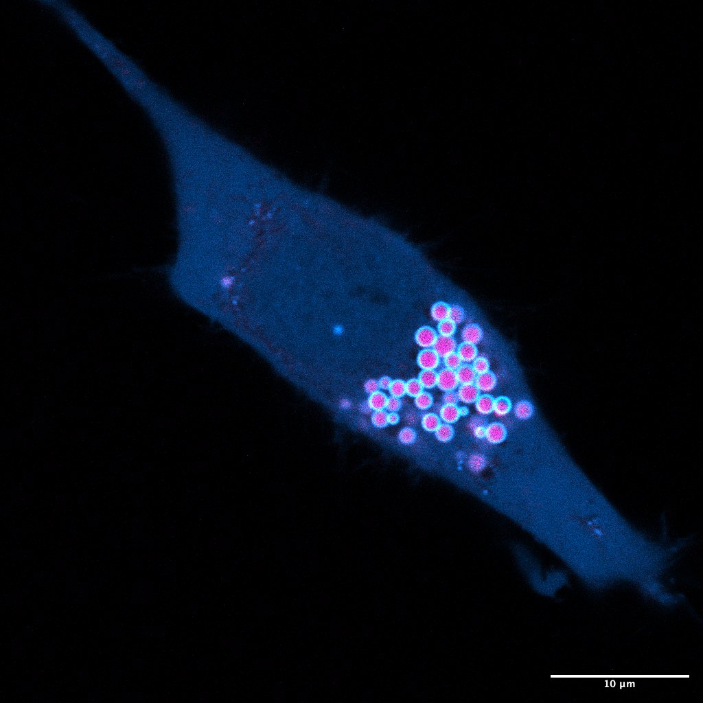 Cell in blue with a cluster of magenta lipid droplets