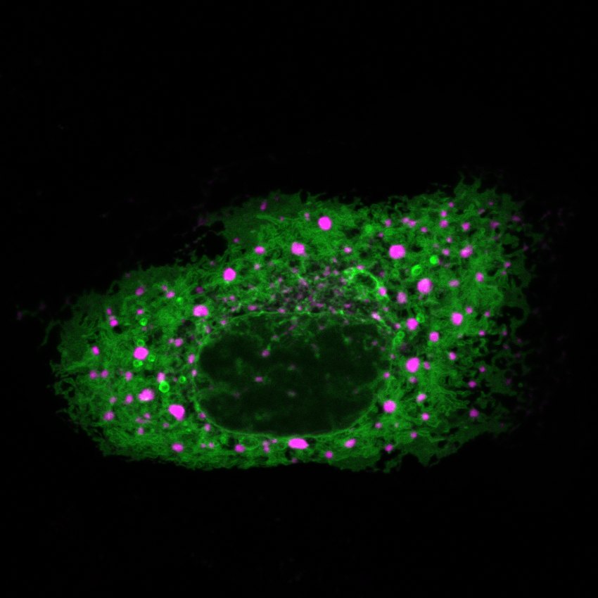 Cell with a green membrane network and magenta lipid droplets