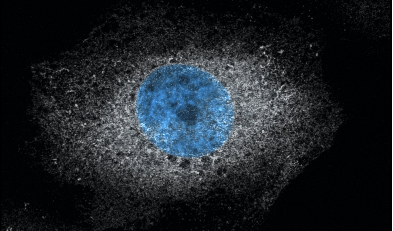 Cell with membranes in white around a blue nucleus